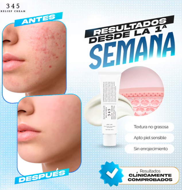 Con la crema 345 tu piel puede calmarse y verse perfecta sin filtros