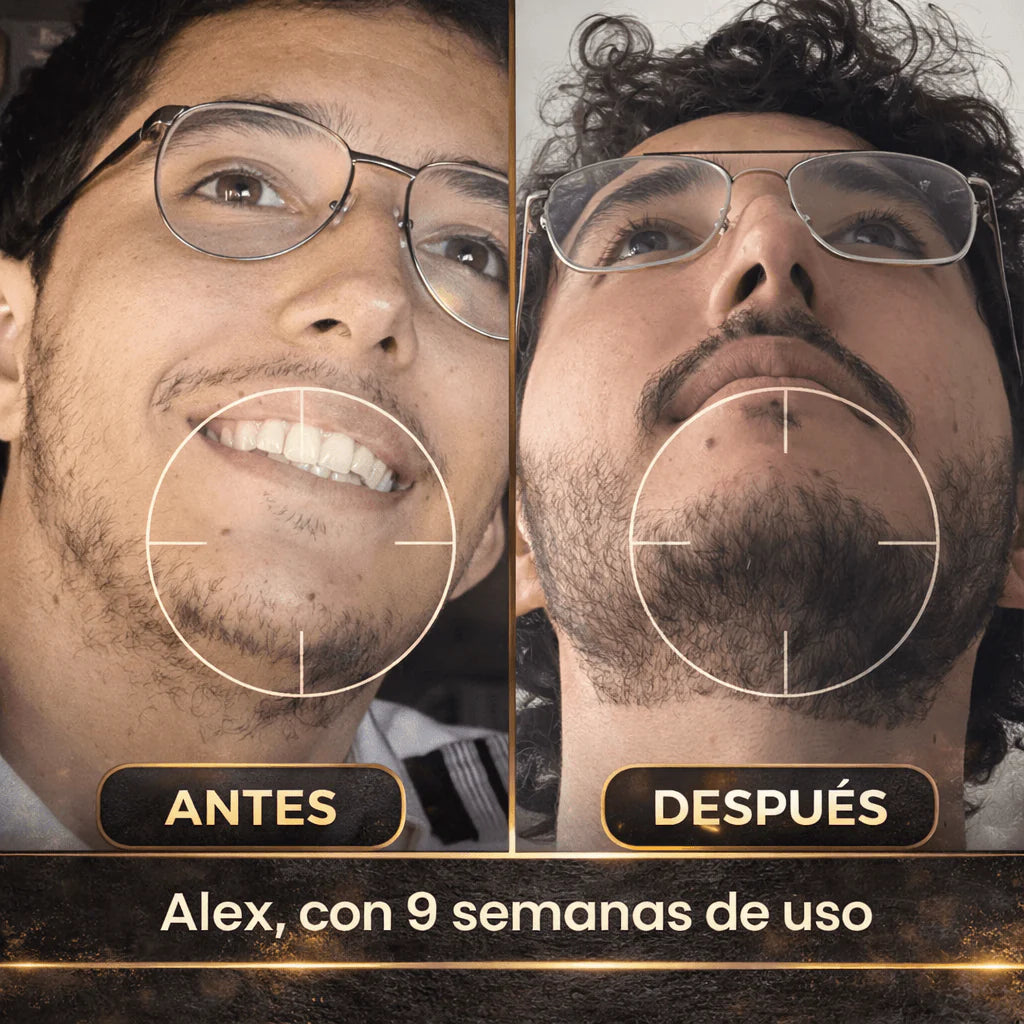 🔥 Bálsamo Estimulante de Barba Apolo – Activa una Barba Más Cerrada y con Más Presencia